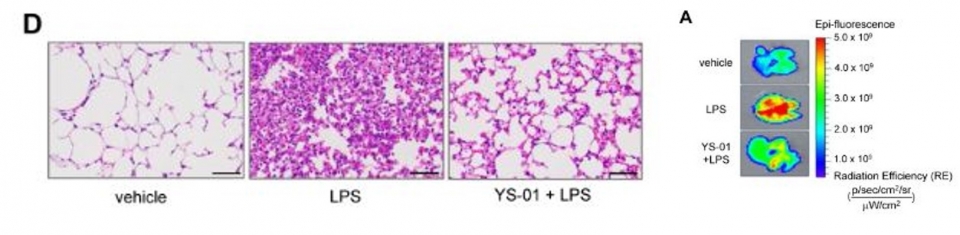 (図左)  vehicle:肺損傷のない正常マウス肺 / LPS:細菌毒素を注入して急性肺損傷が起きたマウス肺 / YS-01+LPS:ペンドリン阻害剤(YS-01)を使用して肺損傷が緩和されたマウス肺 (図右) 肺損傷時に発現が増加するNF-Kb活性度を蛍光画像分析によって見せてくれた絵 (赤色がNF-kB活性を意味、赤いほどは肺の損傷が多いことを意味する)