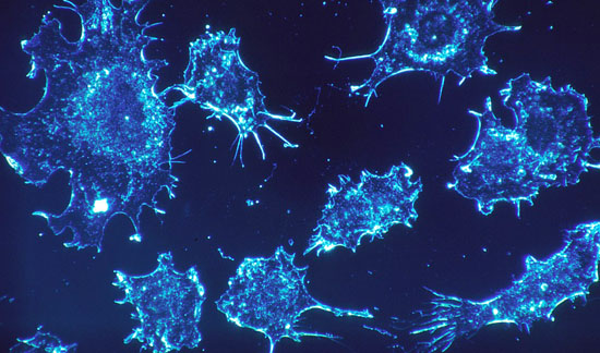 암세포는 최소한의 에너지와 혈액공급만으로도 생존한다는 연구결과가 나왔다.