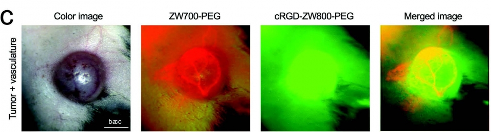 폐암 세포주를 이용하여 성립된 마우스 암 모델에서  ZW700-PEG과 cRGD-ZW800-PEG을 이용한 혈관 및 암 탐색 결과.
