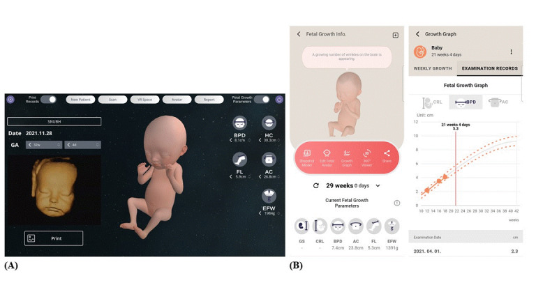 (왼쪽부터) 초음파를 기반으로 가상현실에서 생성된 태아의 모습, 초음파에서 변환된 데이터와 태아 성장 보여주는 그래프