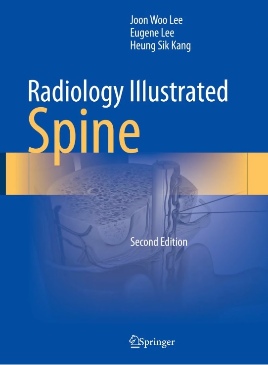 ‘Radiology Illustrated: Spine(영상진단 척추편)’ 2판 표지