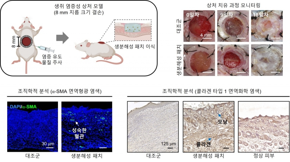 생쥐 염증성 상처 모델에서 나노입자 담지 패치 이식 후 평가 나노입자 담지 생분해성 패치를 생쥐 염증성 상처 모델에 이식한 결과, 상처 치유 속도가 개선된 것을 확인하였음. 조직학적 분석을 통해 대조군 대비 다량의 성숙한 혈관 구조와 모낭 및 콜라겐 구조가 재건되며 실제 피부와 비슷한 조직 재생이 이루어진 것을 확인함. [그림설명 및 제공=한양대학교 신흥수 교수]